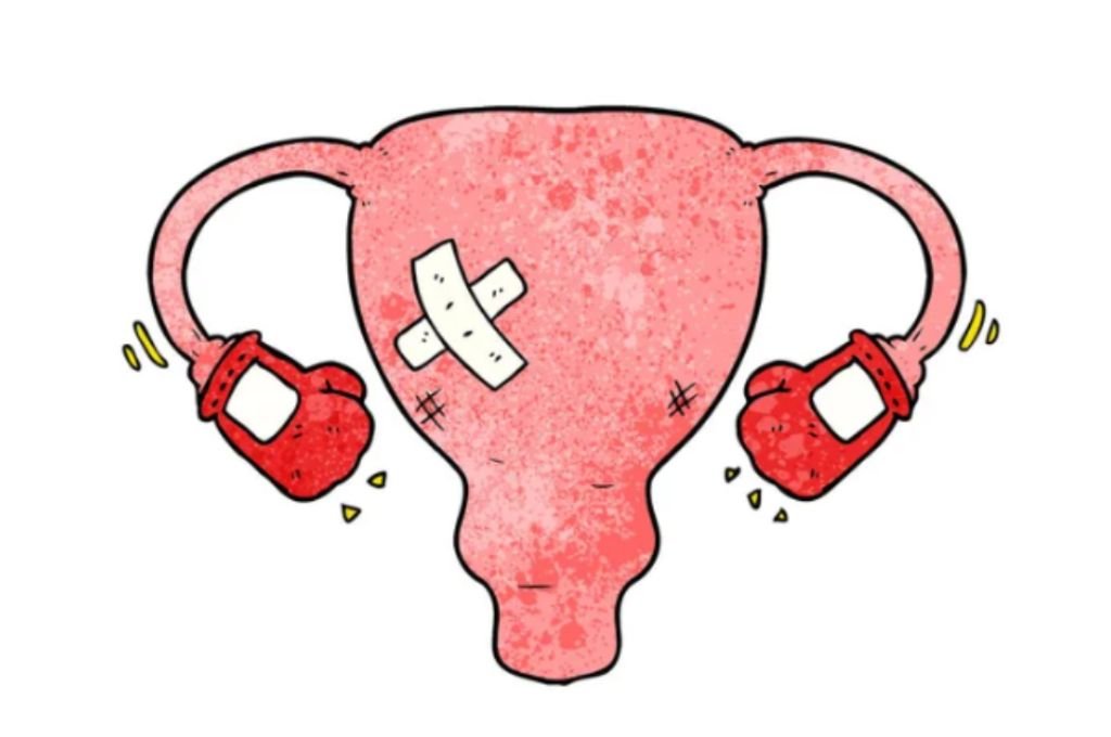 Endometrioses awareness month – march 2023