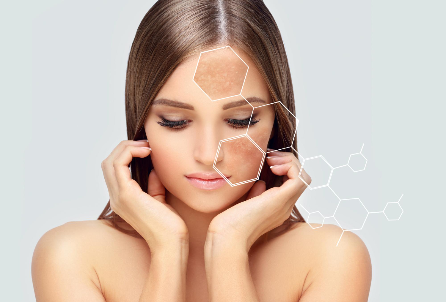 How to Remove Pigmentation From Face: A Complete Guide