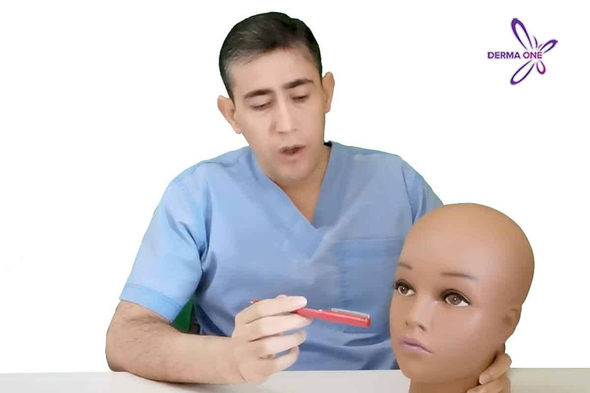 botox for a gummy smile