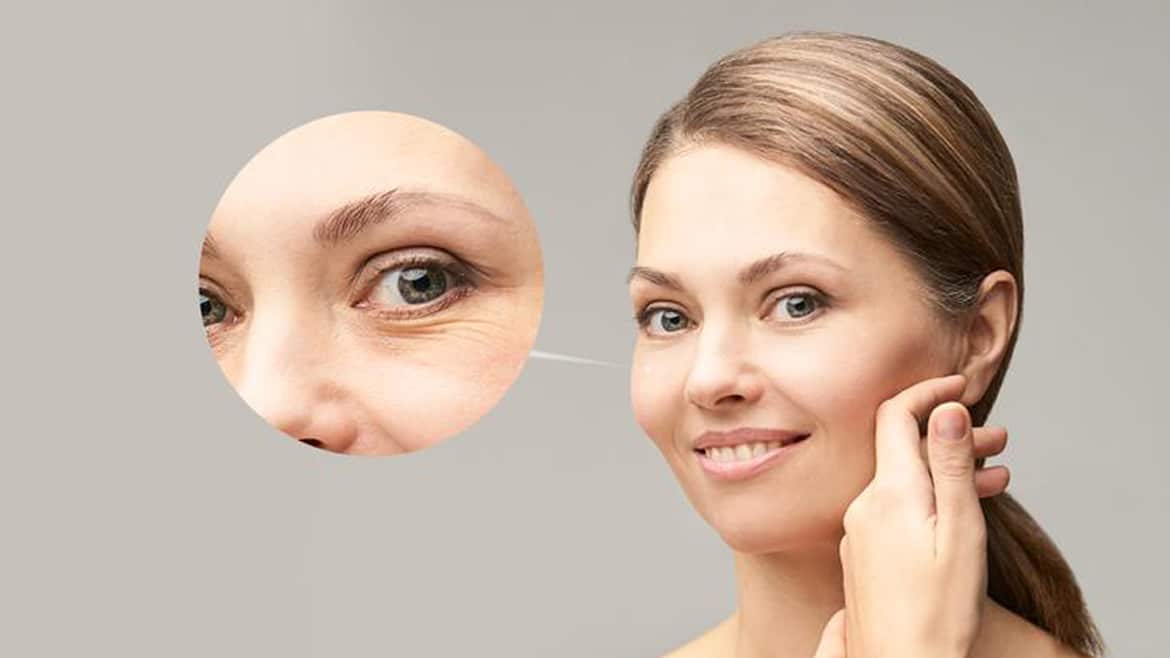 Botox for Under Eye Wrinkles in Dubai