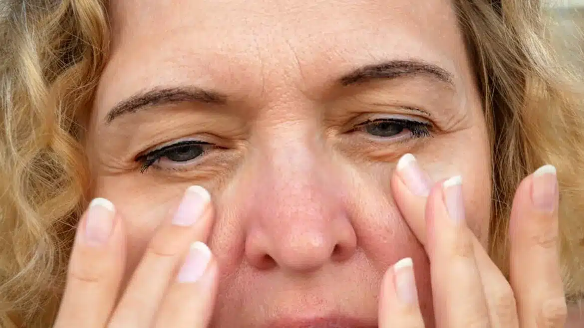 How to Prevent and Treat Wrinkles in dubai-1170x658
