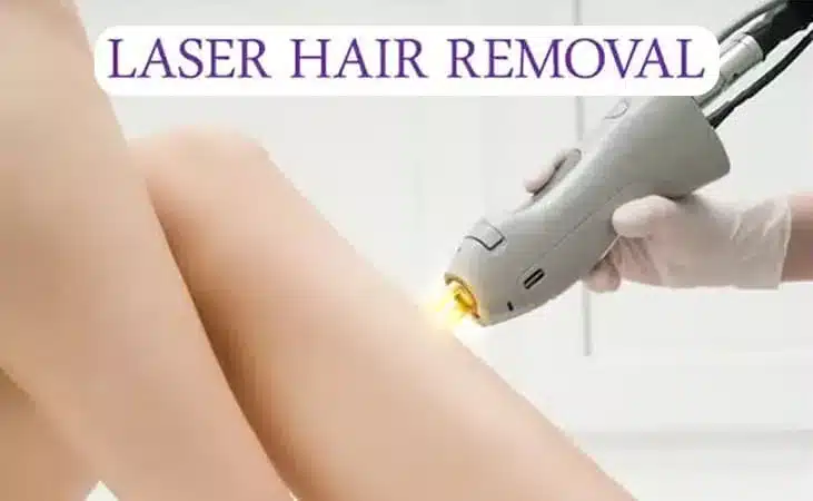hair removal laser in dubai