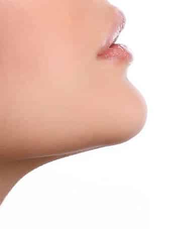 Botox for Chin Dimpling Dubai