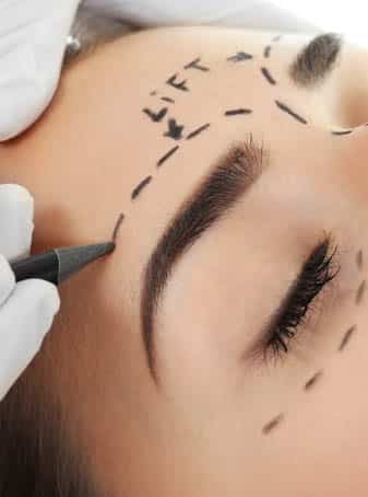 Eyebrow Lift