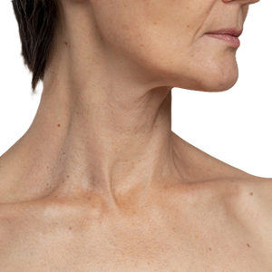 Neck tightening dubai