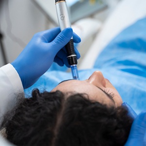 Microneedling dubai 300x300