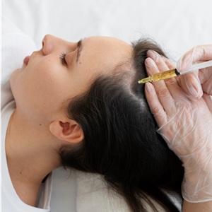 Microneedling with prp dubai