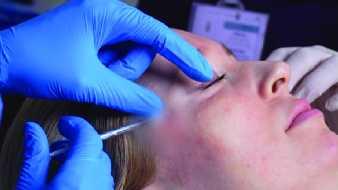 Preventative Botox Dubai