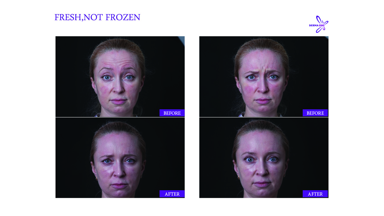 FRESH,NOT FROZEN Brotox