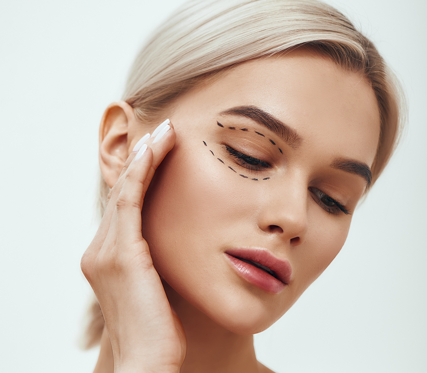 Blepharoplasty