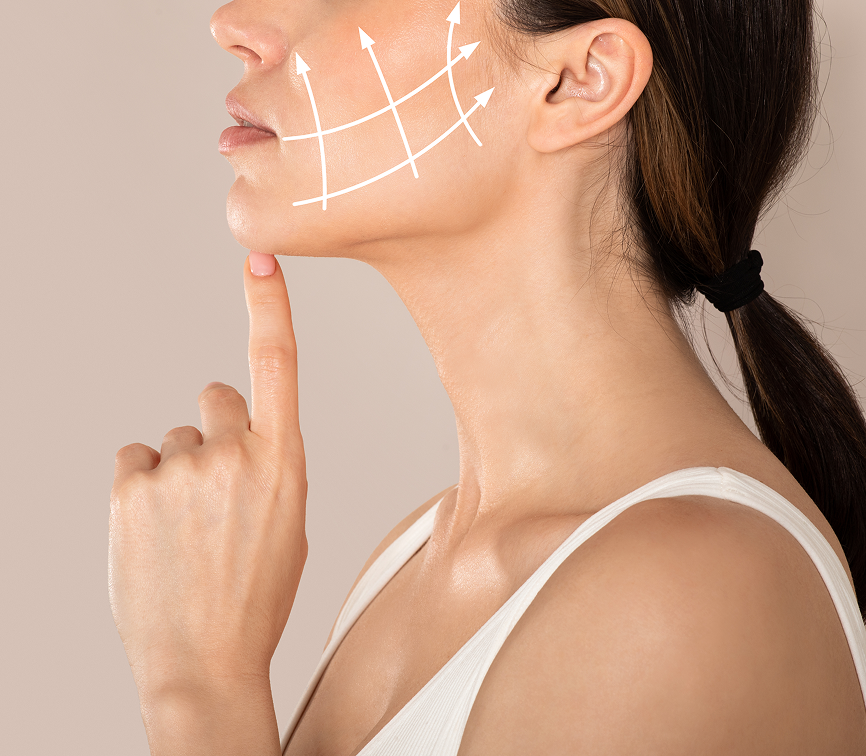 Deep Plane Facelift