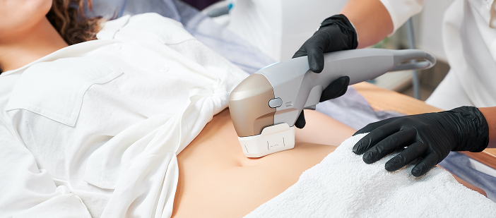 Tummy Tuck